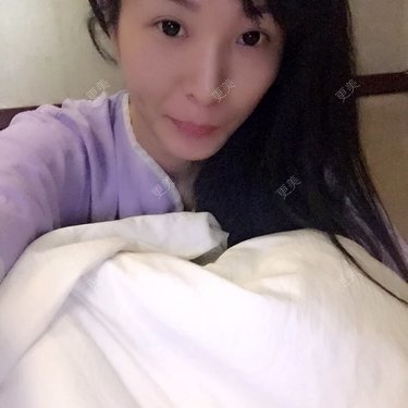 太阳穴