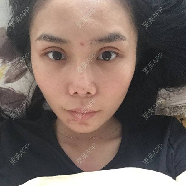 更美 - o👃🏻的经验 | 肤质检测 | 深圳