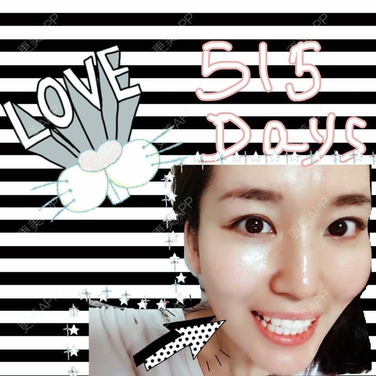更美 - 💓大极💓的隐形牙齿矫正经验 | 北京 | 牙齿正畸 | 隐适美 | 矫正牙齿 | 隐形牙齿矫正