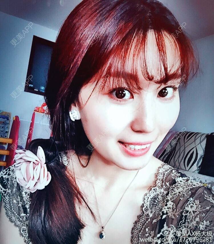 更美 - 💓大极💓的隐形牙齿矫正经验 | 北京 | 牙齿正畸 | 隐适美 | 矫正牙齿 | 隐形牙齿矫正