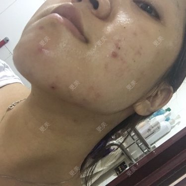 小雪妹妹