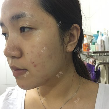 小雪妹妹