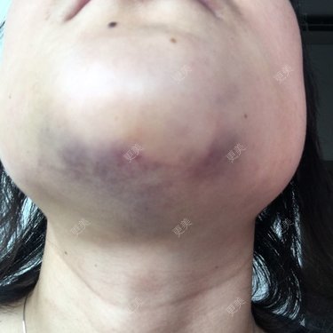 更美用户9725051188