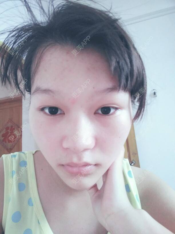 更美 - 半粒糖，甜到殇的经验 | 鼻部多项 | 韶关