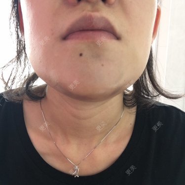 更美用户9725051188