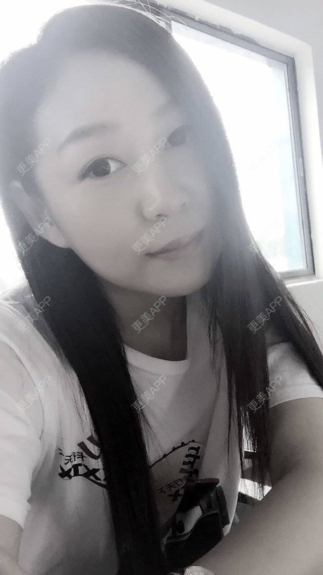 更美 - weenie的玻尿酸经验 | 美购日记 | 玻尿酸注射法令纹下巴 | 玻尿酸 | 深圳