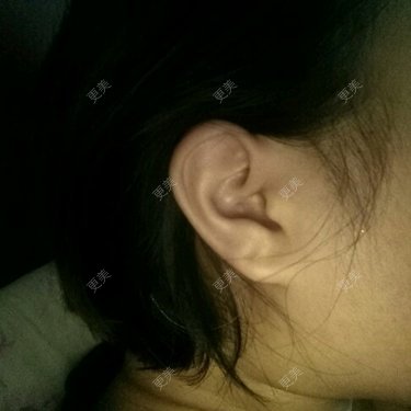 好了伤疤忘了疼~贱