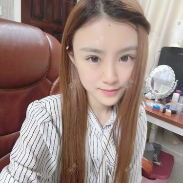 垫眉弓