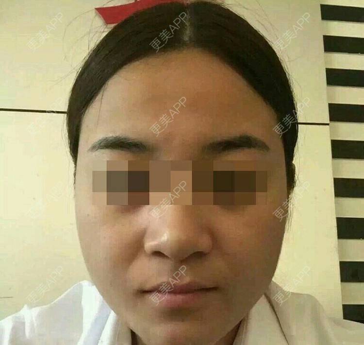 更美 - 谦谦君子就是我的除皱瘦脸经验 | 除皱瘦脸 | 注射瘦脸· | 武汉