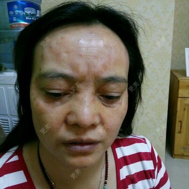 更美用户0BUephUhtV