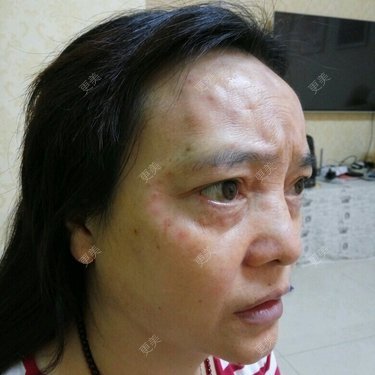 更美用户0BUephUhtV