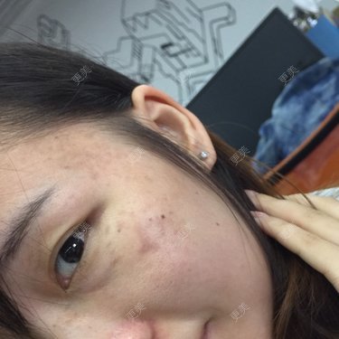 石榴裙