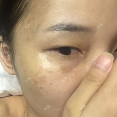 石榴裙