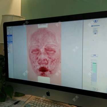 更美用户xRCKwVIwtw