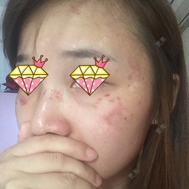 石榴裙
