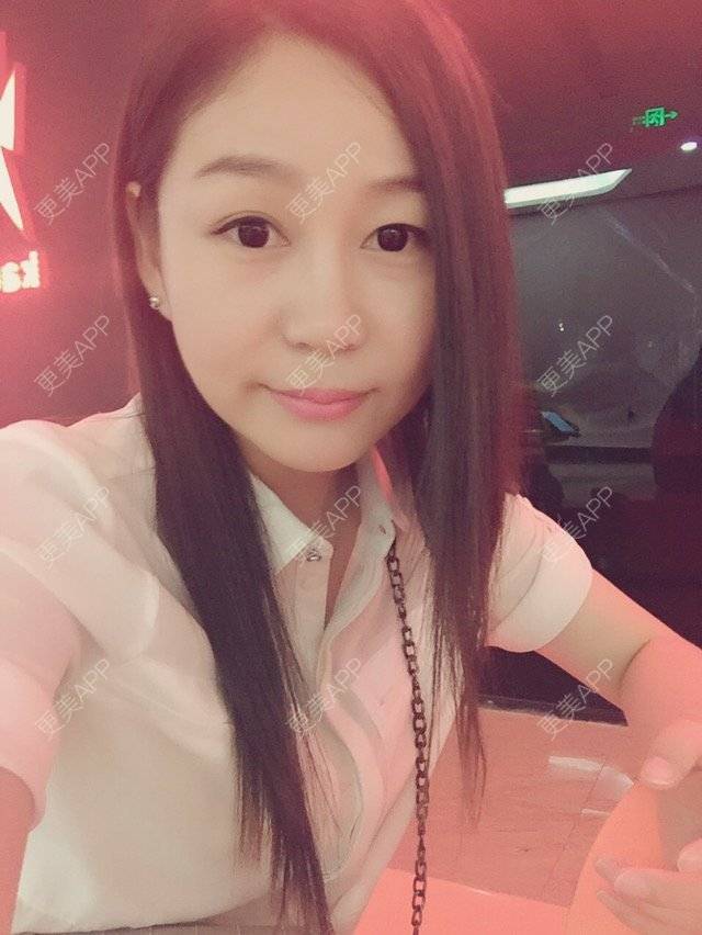 更美 - weenie的玻尿酸经验 | 美购日记 | 玻尿酸注射法令纹下巴 | 玻尿酸 | 深圳
