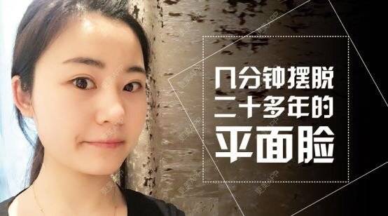 更美 - 上海芙艾门诊部的玻尿酸经验 | 注射美容 | 鼻部整形 | 玻尿酸 | 上海