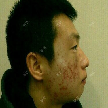 苦涩又心动