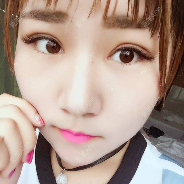 最初的小雅的全切双眼皮日记