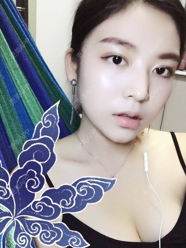 更美 - 彼岸花娇儿的眼皮下垂矫正经验 | 眼皮下垂矫正 | 全切开双眼皮 | 上眼睑下垂矫正术 | 成都