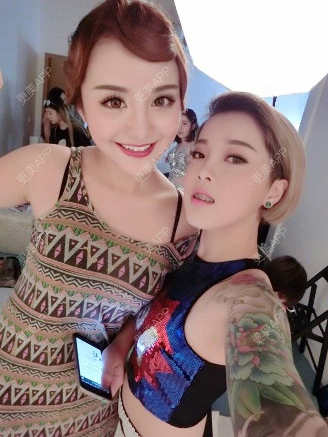 更美 - Joni小小板娘的上下颚手术经验 | 上下颚手术 | 我要上精选 | 地包天 | 上海