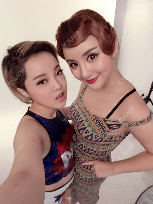 更美 - Joni小小板娘的上下颚手术经验 | 上下颚手术 | 我要上精选 | 地包天 | 上海