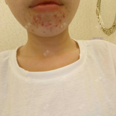 苏苏99