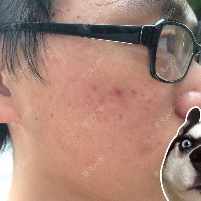 猫的祛疤痕痘印日记