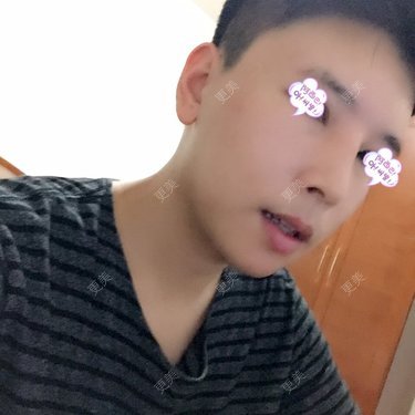 Ping_