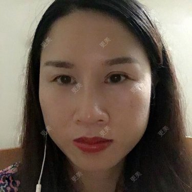 玲妹妹的蜕变