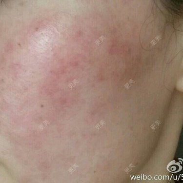 zts李大人