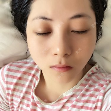suriyoung