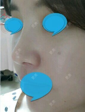 费解