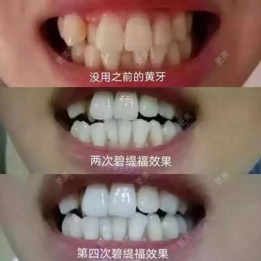 小小小小小小确幸0