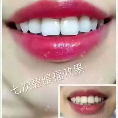 小小小小小小确幸0
