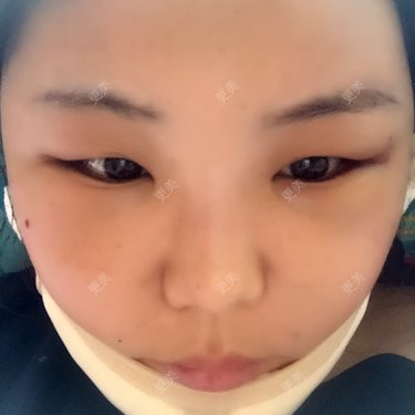 更美用户HUUnXNAHU9