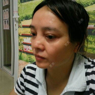 更美用户0BUephUhtV