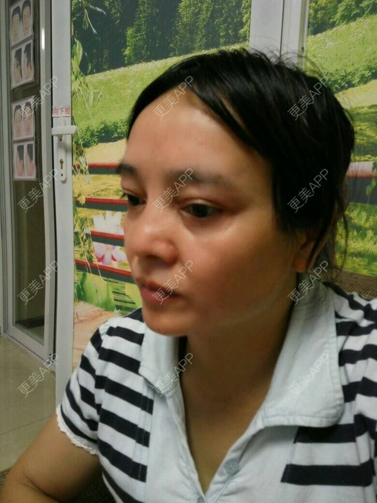 更美 - 更美用户0BUephUhtV的眼部护理经验 | 眼部护理 | 除皱 | 成都