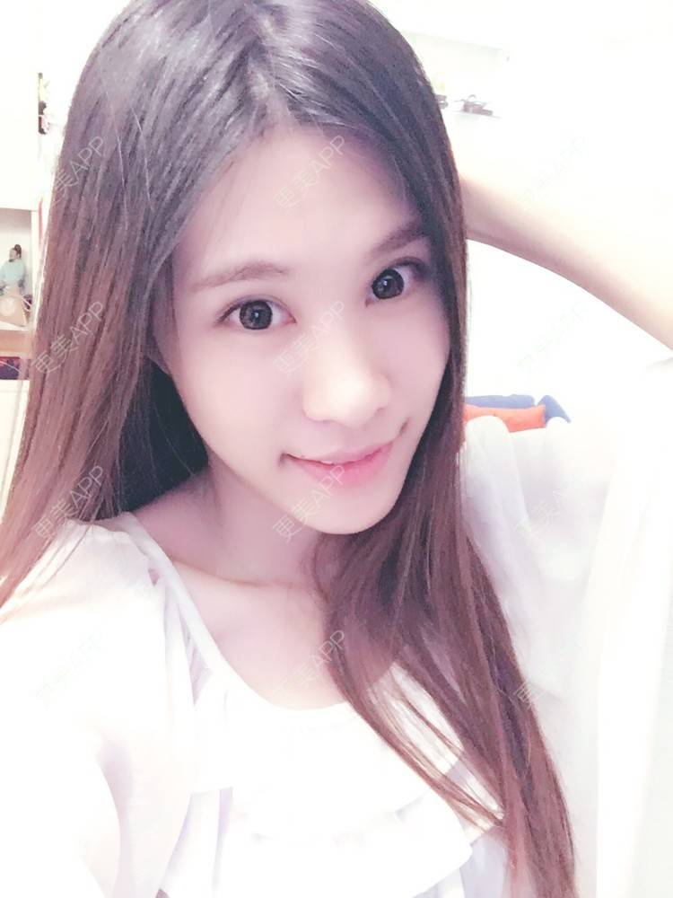 更美 - 圆又圆丁的玻尿酸经验 | 玻尿酸法令纹 | 美购日记 | 玻尿酸 | 上海