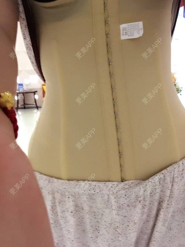 更美 - 瑗瑗要么瘦要么死的腰腹吸脂经验 | 腰腹部吸脂 | 吸脂瘦腰腹 | 腰腹吸脂 | 重庆