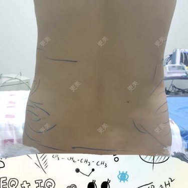 瑗瑗要么瘦要么死