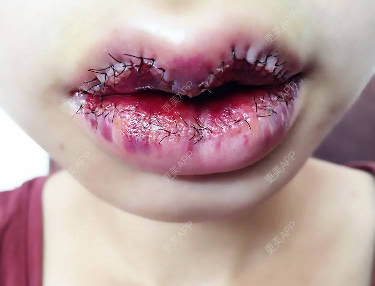 高冷病人的唇形日记