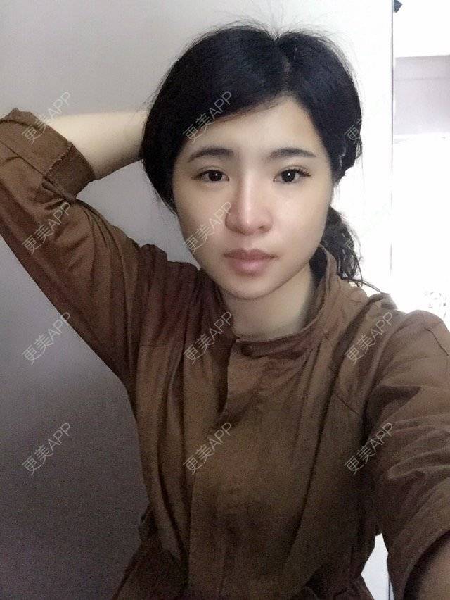 更美 - Y·的经验 | 鼻部多项 | 上饶