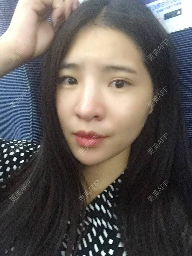 更美 - Y·的经验 | 鼻部多项 | 上饶