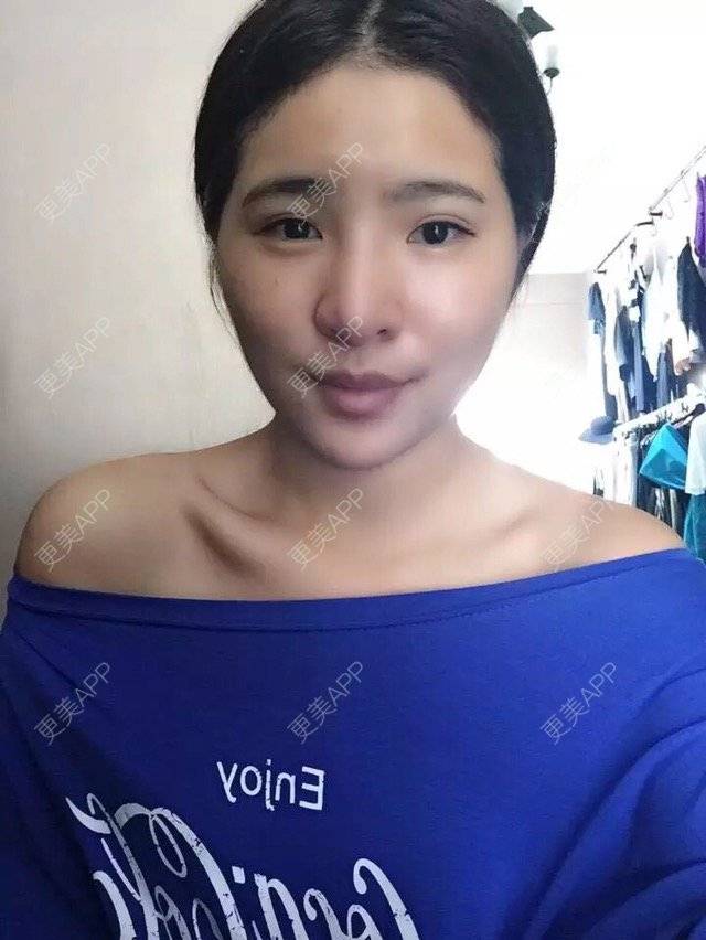 更美 - Y·的经验 | 鼻部多项 | 上饶