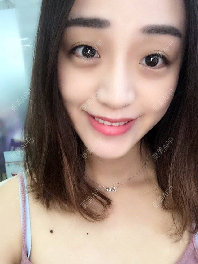 更美 - 损损的牙齿美白经验 | 白牙免费送 | 其他 | 冷光美白 | 美购日记 | 牙齿美白 | 冷光美白1 | 北京