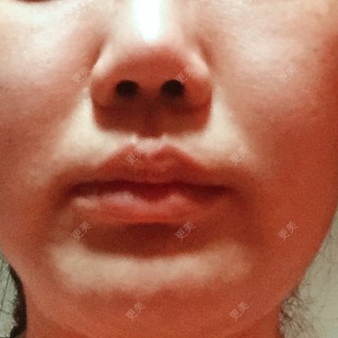 更美用户639188