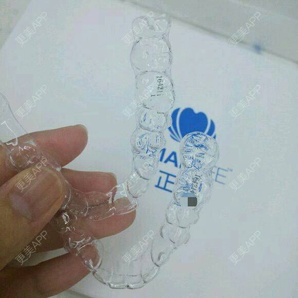 更美 - 乐莎莎口腔的隐形牙齿矫正经验 | 晒对比照 | 牙齿矫正 | 隐形牙齿矫正