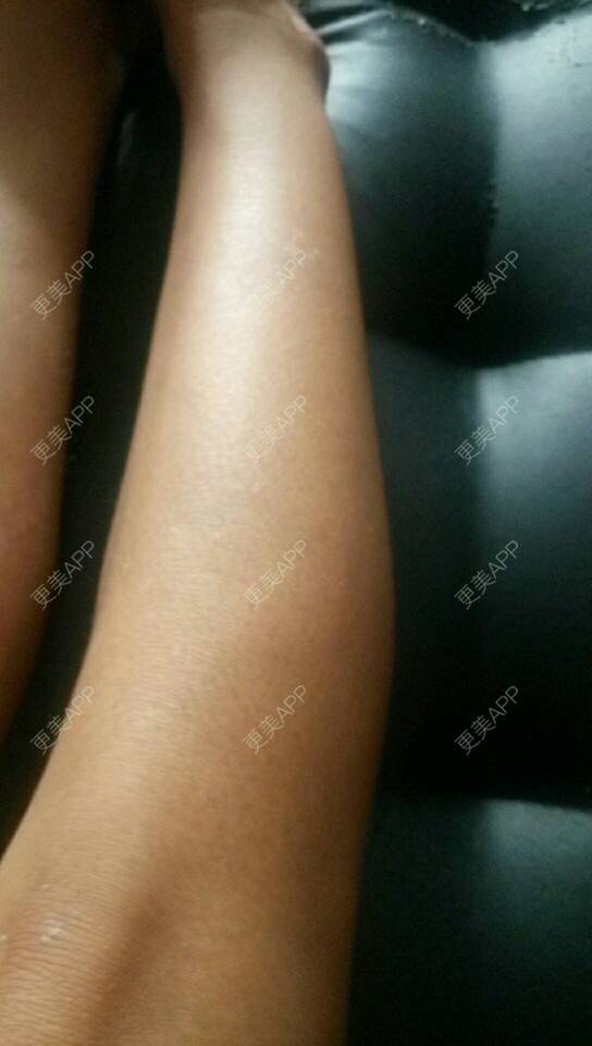 更美 - 更美用户HKo6sLP5KR的经验 | 美白 | 许昌