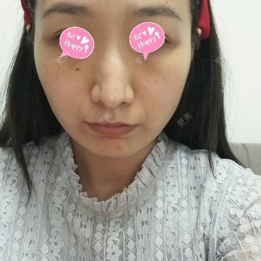 刘小肥